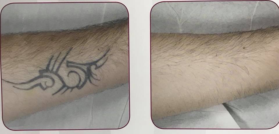 I tatuaggi